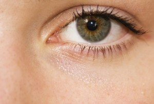 Galvanic SPA - Das Problem liegt unter der Haut